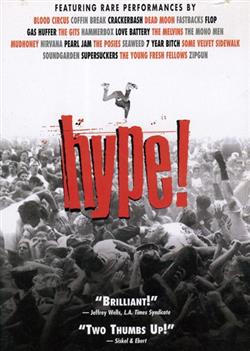 lytte på nettet Doug Pray - Hype