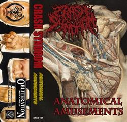 Download Crash Syndrom - Anatomical Amusements